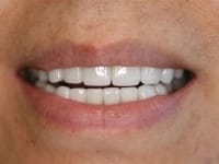 Konig Center for Cosmetic & Comprehensive Dentistry smile photos